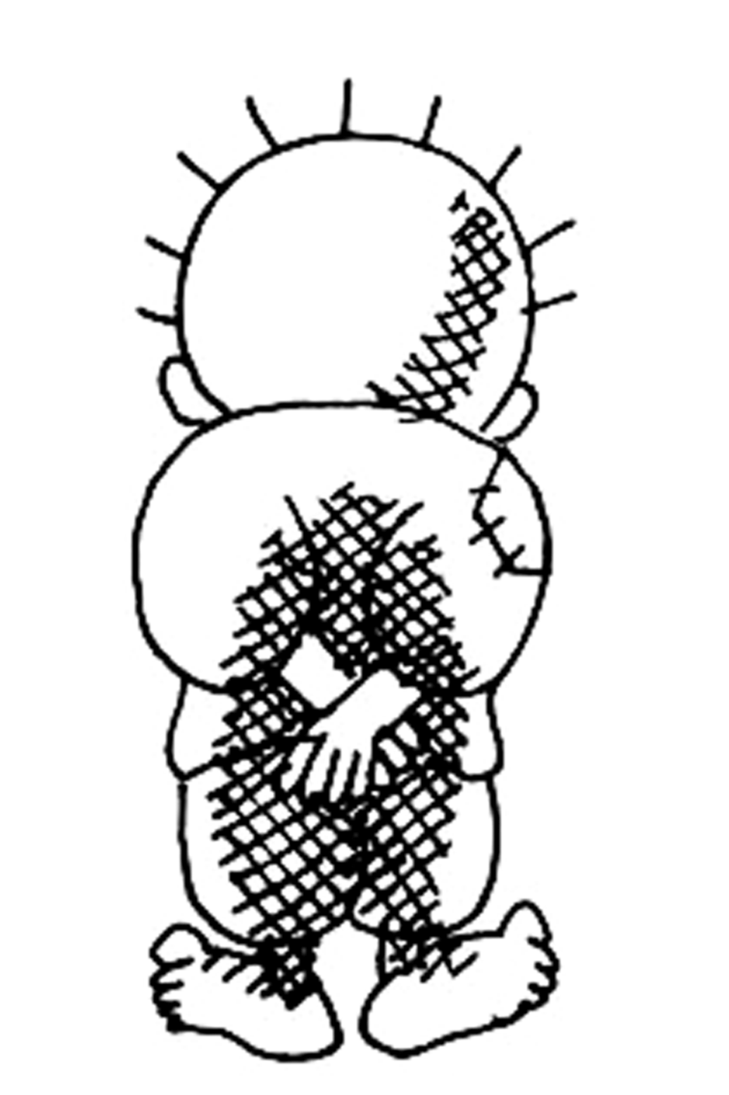 Uludağ İntifadası